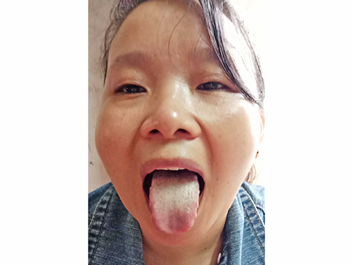 134、三高心脑血管.jpg