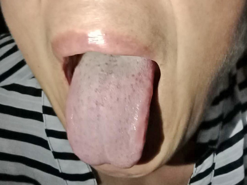 111、成功案例.jpg
